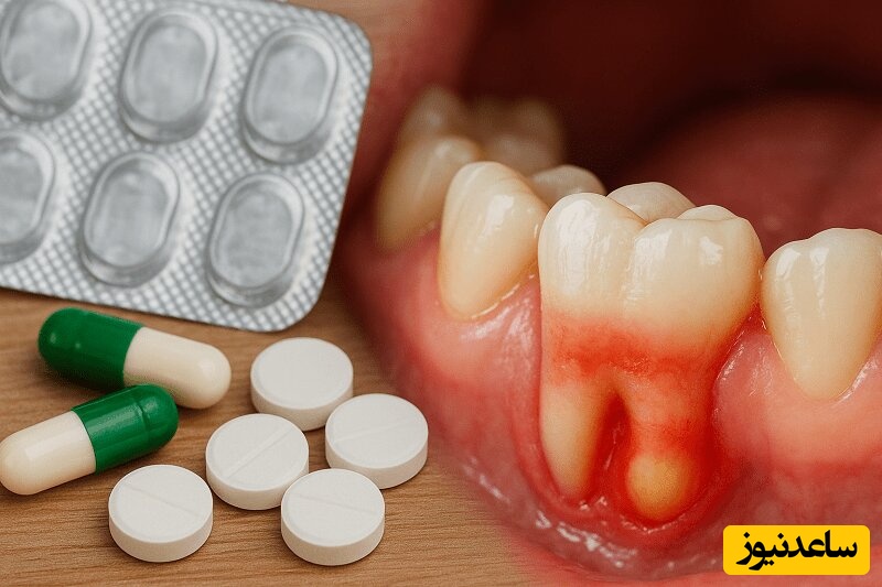 عفونت دندان و پخش شدن آن در بدن