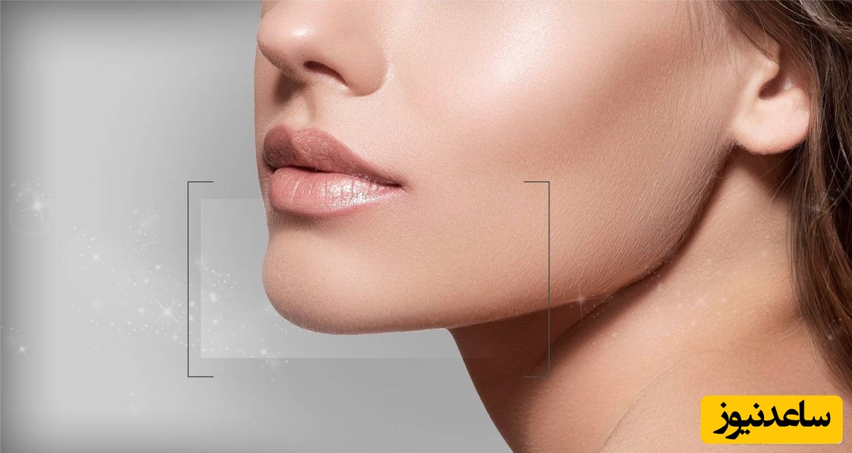 زاویه دار کردن چانه با درمان‌ های غیر جراحی