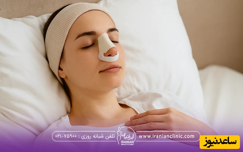 خانمی که بعد از عمل بینی خود به طور صحیح خوابیده است