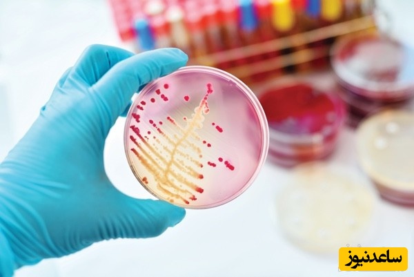 نمونه کارنامه و ظرفیت پذیرش رشته میکروب شناسی پزشکی در مقطع کارشناسی ارشد