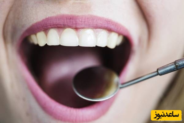 لمینیت دندان برای چه افرادی مناسب و برای که نامناسب است؟