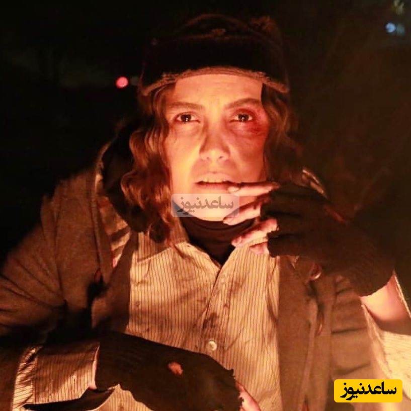 تغییر چهره سامیه لک