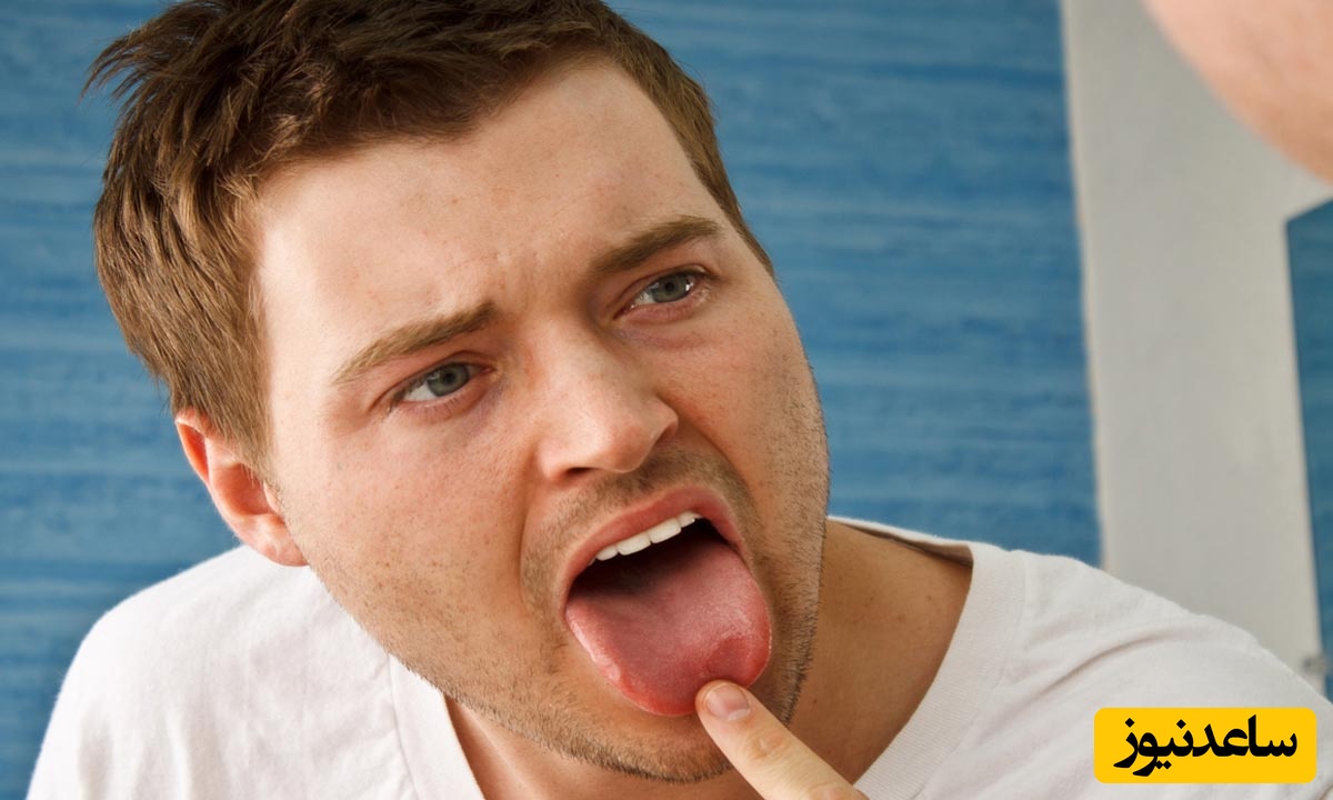 طعم تلخ را در دهان چه چیزی ایجاد می کند؟