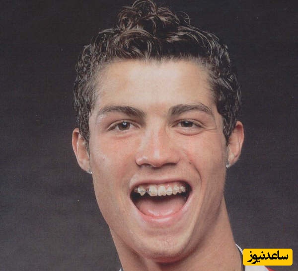 تغییرچهره زمین تا آسمان رونالدو با ارتودنسی و اصلاح لبخند/ نمونه واقعی ما زشت نیستیم فقط پول نداریم😂+عکس