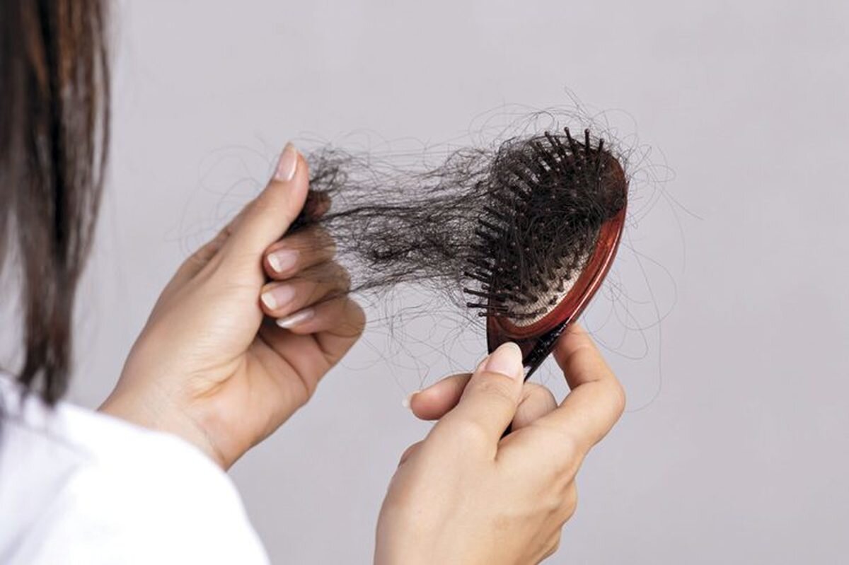 با 8 روش خانگی تونیک ضد ریزش موی معجزه آسا تهیه کنید!