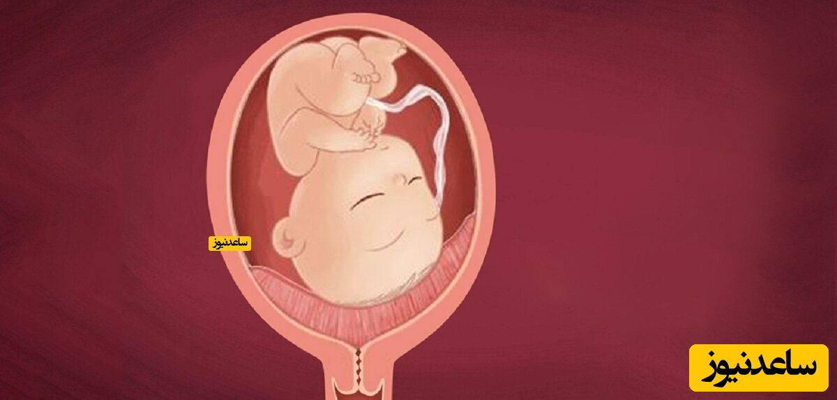 آیا زایمان طبیعی با جفت سر راهی امکان پذیر است؟