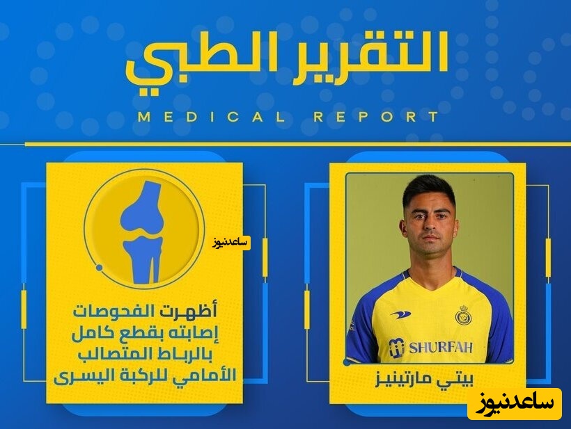 پیتی مارتینز