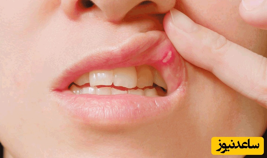 راه های آسان برای کم کردن درد عفونت دندان