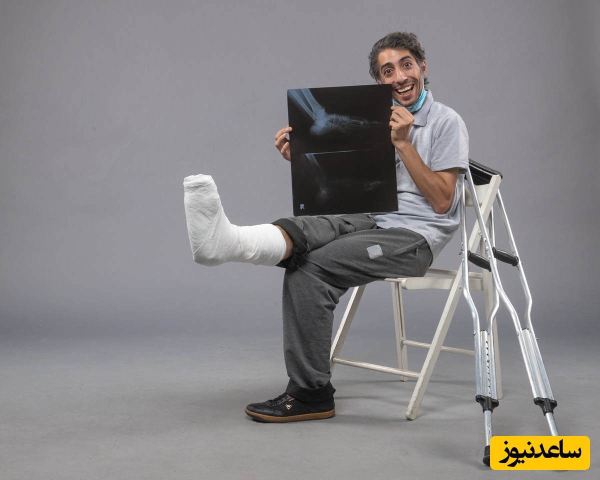 (ویدئو) دوران گچ‌گرفتن تمام شد؟ نوآوری جدید چینی‌ها درمان شکستگی را برای همیشه تغییر می‌دهد