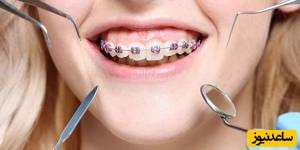  مرحله اول و دوم درمان ارتودنسی چیست؟