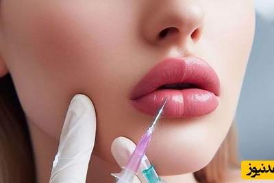 دنیای سلامت؛ مراقبت های ضروری بعد از تزریق ژل لب