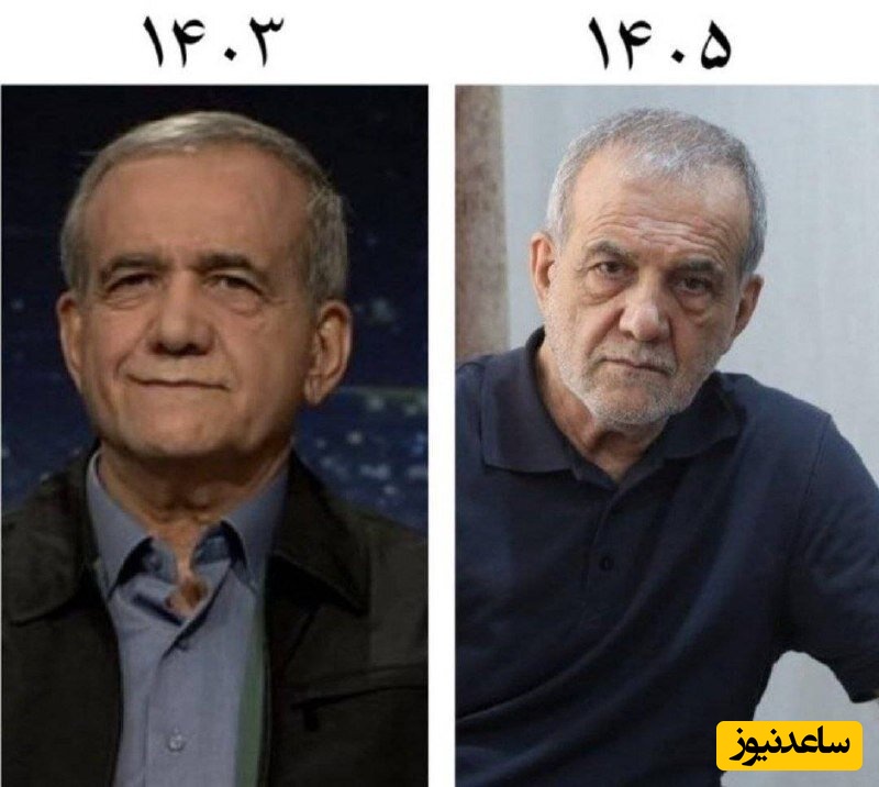 تغییر قیافه دکتر مسعود پزشکیان از زمان انتخابات تا اکنون