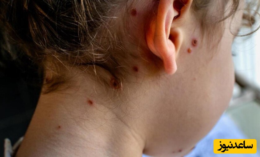 عوامل محیطی و باکتریها