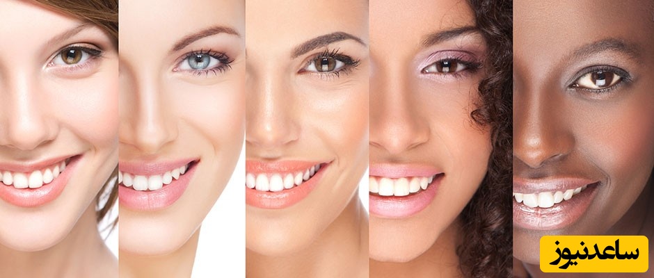 اگر می خواهید لبخند زیبا داشته باشید بخوانید!