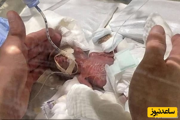 کوچکترین نوزاد پسر دنیا به خانه رفت