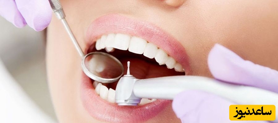 پروسه جرمگیری دندان چگونه است؟