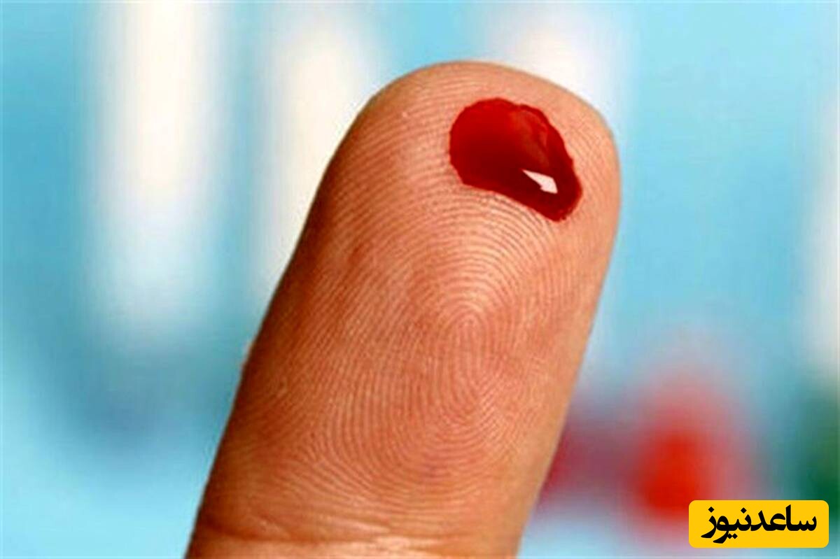 دیدن خون در خواب چه تعبیری دارد؟ / تعبیر خواب خون + فیلم