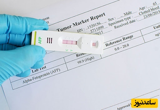 آزمایش بتا در بارداری چیست؟ زمان دقیق انجام، تفسیر نتایج و اهمیت آن برای تشخیص حاملگی