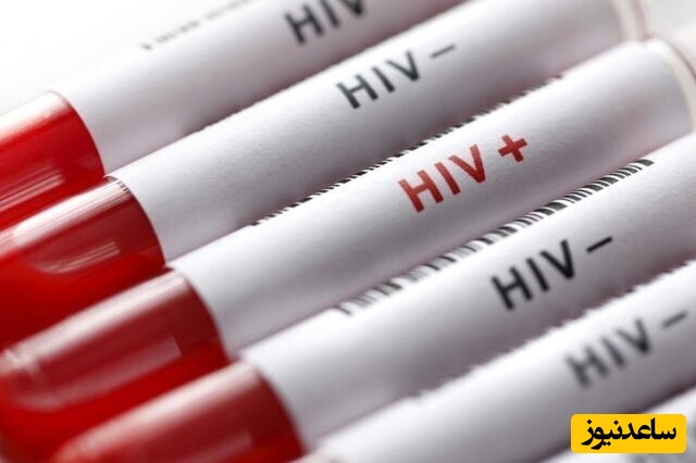 نشانه‌های اولیه عفونت HIV و مبتلا شدن به ایدز