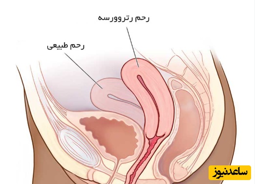 رحم