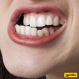 درمان گیاهی دندان قروچه چیست؟