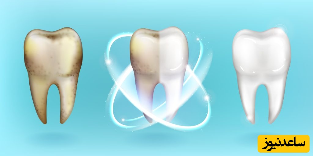 علل بروز جرم دندان چیست ؟