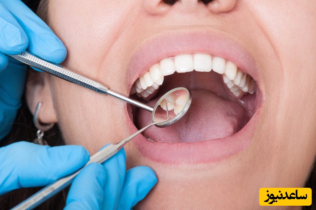 برنامه غذایی نادرست و تاثیر آن بر دهان و دندان