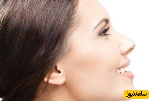 دلایل کوچک بودن فک پایین