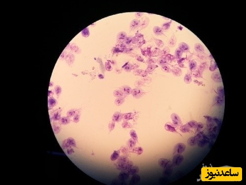 نمونه کارنامه و ظرفیت پذیرش رشته انگل شناسی پزشکی در مقطع کارشناسی ارشد