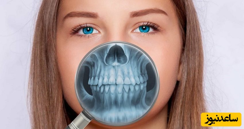 کیست فک چیست؟