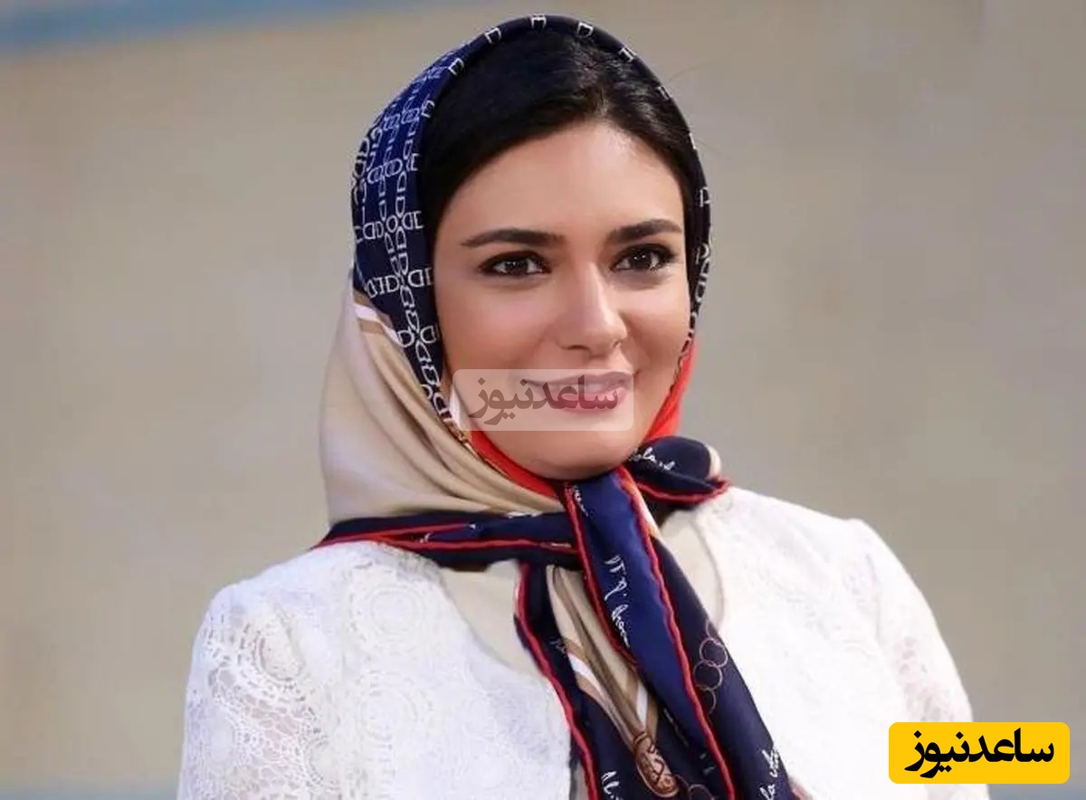 لیندا کیانی تغییر چهره داد ؛ خانم بازیگر قابل شناسایی نیست