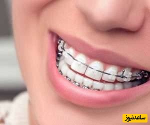 دلایل نیاز به ارتودنسی چیست؟