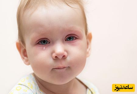 داروهای خانگی برای عفونت چشم کودکان