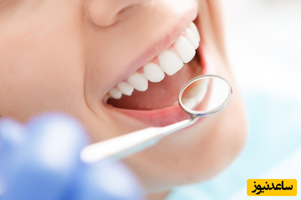 چه نکاتی را قبل از اصلاح طرح لبخند باید در نظر گرفت؟