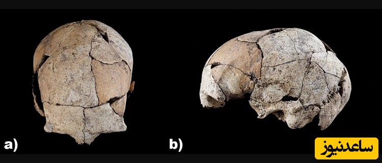 کشف جمجمه‌ای با قدیمی‌ترین شواهد جراحی گوش