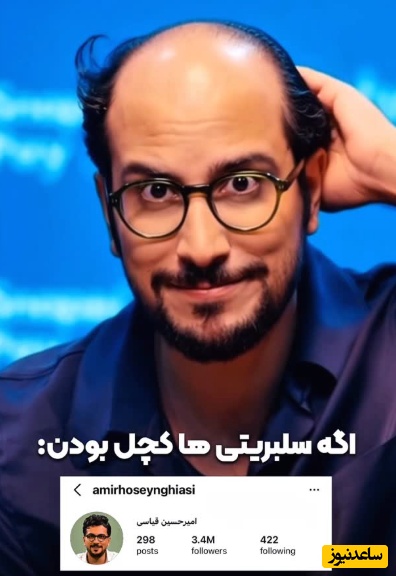 اگر سلبریتی ها کچل بودند چه ریخت و قیافه‌ای داشتن؟؛ فقط جواد خیابانی😂+ویدیو