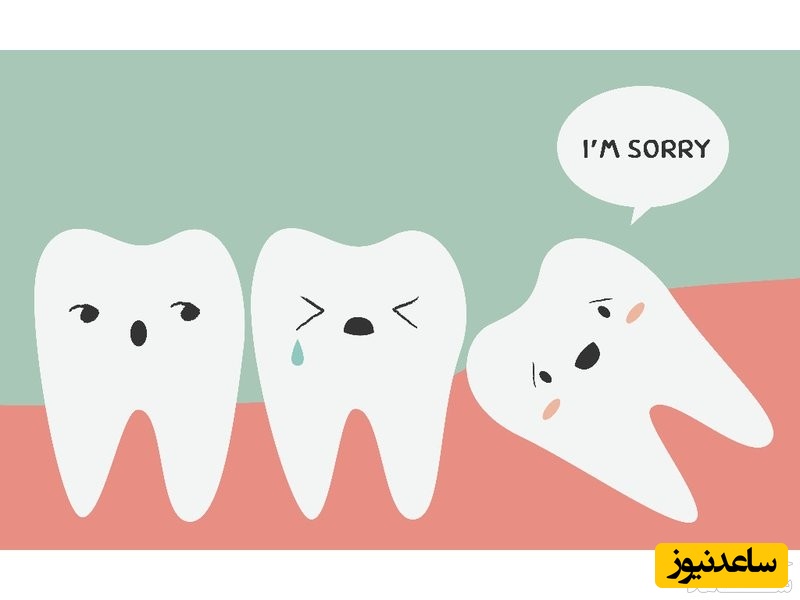 (فیلم) دندان عقل، دندانی بدقلق با مراقبت دشوار