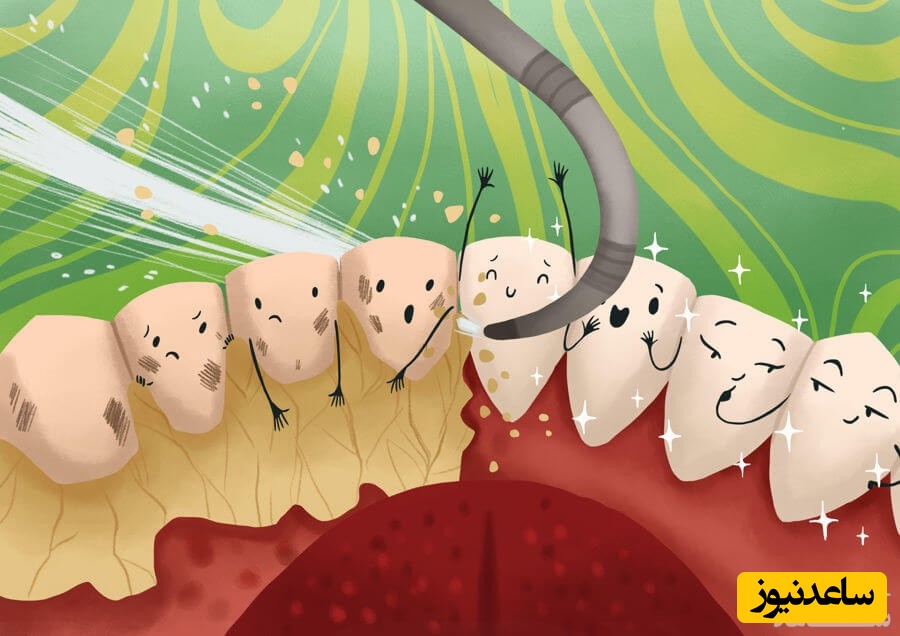 روش های خانگی جرم گیری دندان می تواند جایگزین مراجعه به دندانپزشک باشد؟