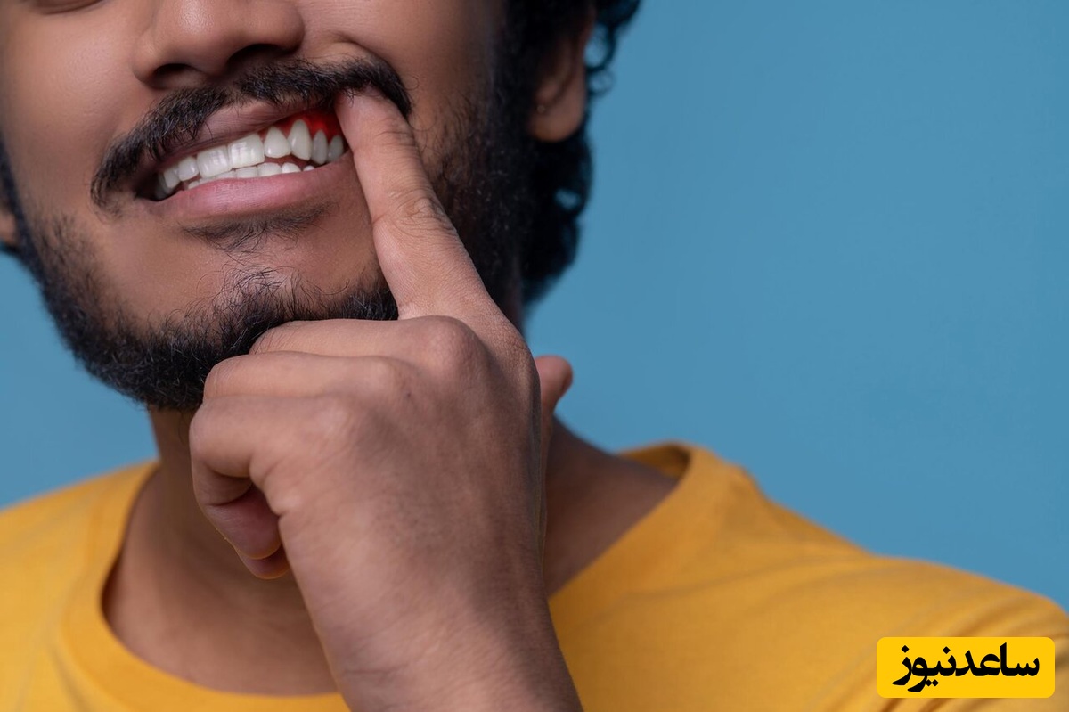 چه عواملی باعث سیاه شدن دندان ها می‌شود؟