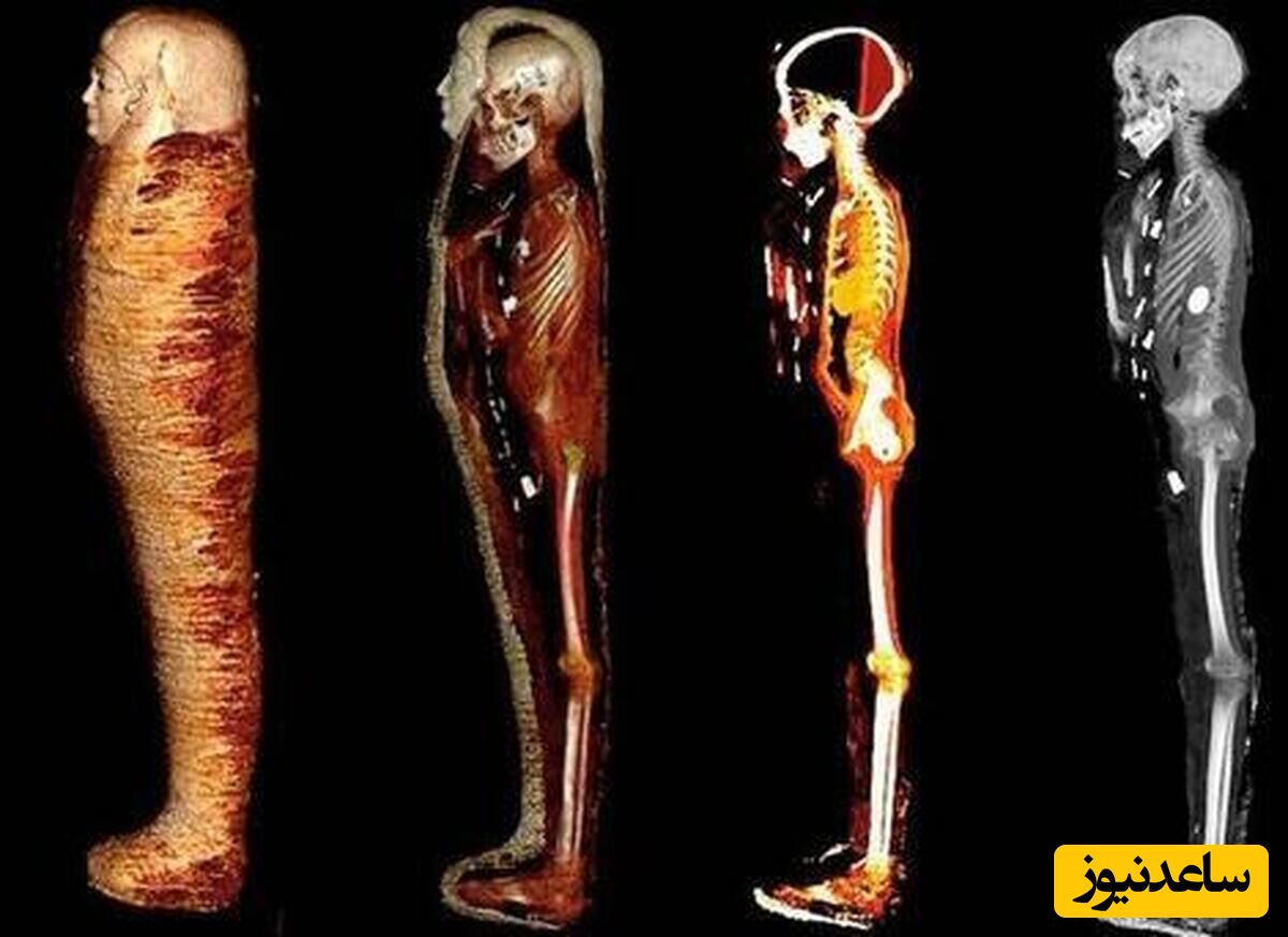 کشف جواهرات کمیاب از داخل مومیایی 2300 ساله در مصر
