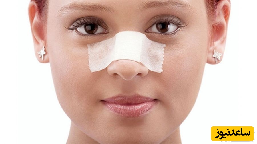 اما و اگرهای برقراری رابطه جنسی بعد از عمل بینی