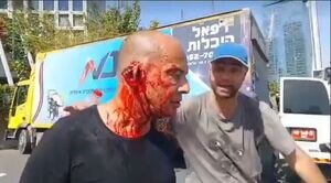 (فیلم 18+) پلیس رژیم صهیونیستی گوش معترضان نتانیاهو را برید!