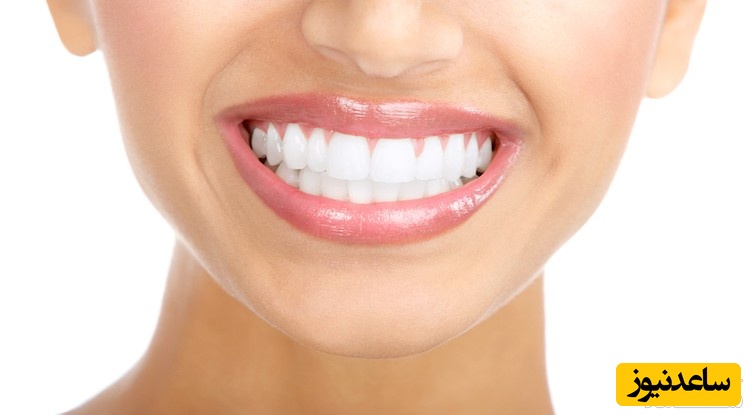 خلاص شدن از ژنژیویت به طور طبیعی در خانه