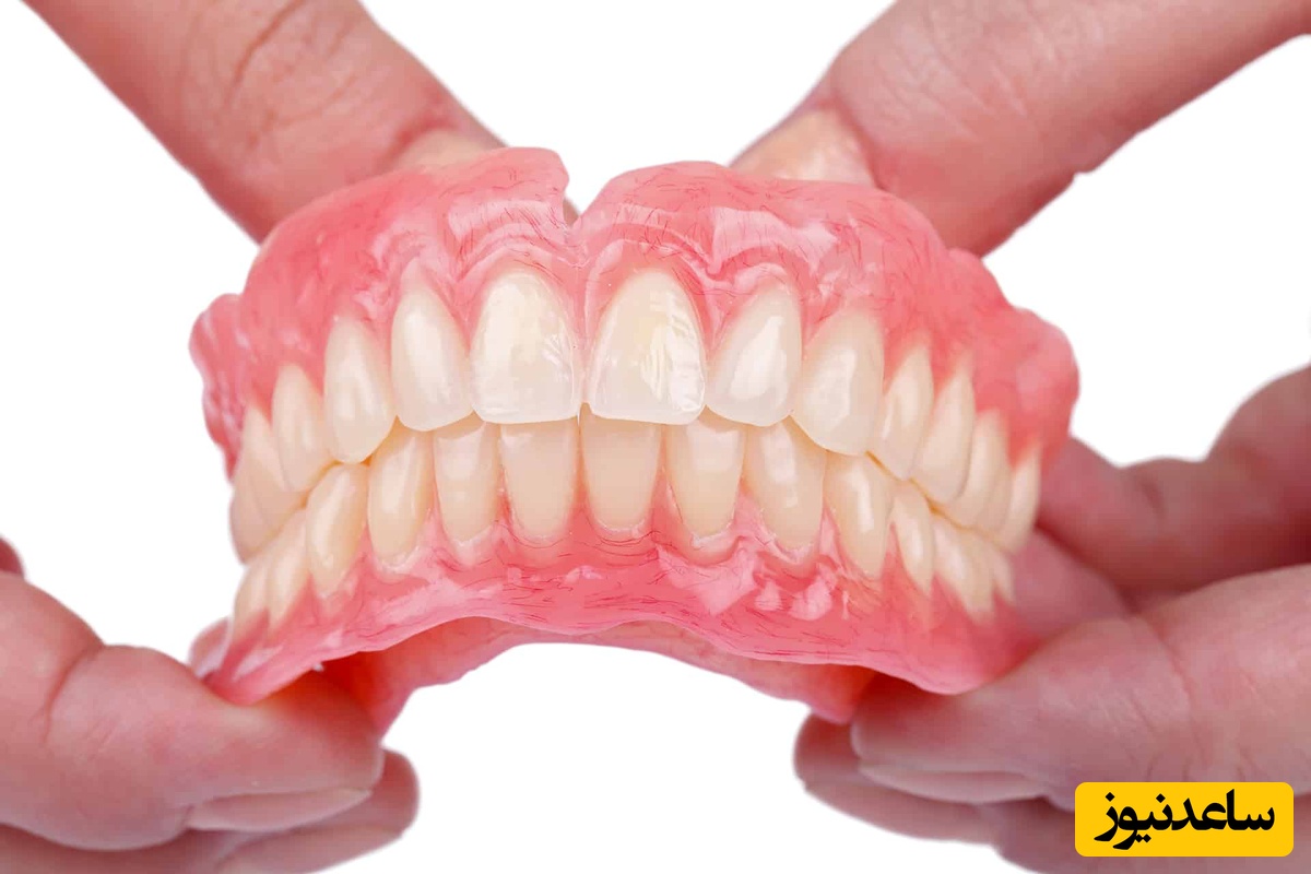 آیا دندان مصنوعی متحرک بهتر است یا سنتی؟