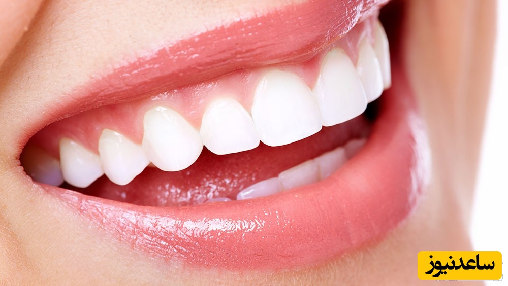 بدترین مواد غذایی برای دندان چیست؟