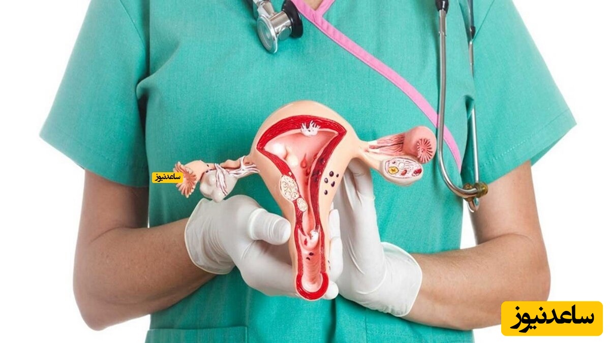 آشنایی با روند جراحی پیوند رحم