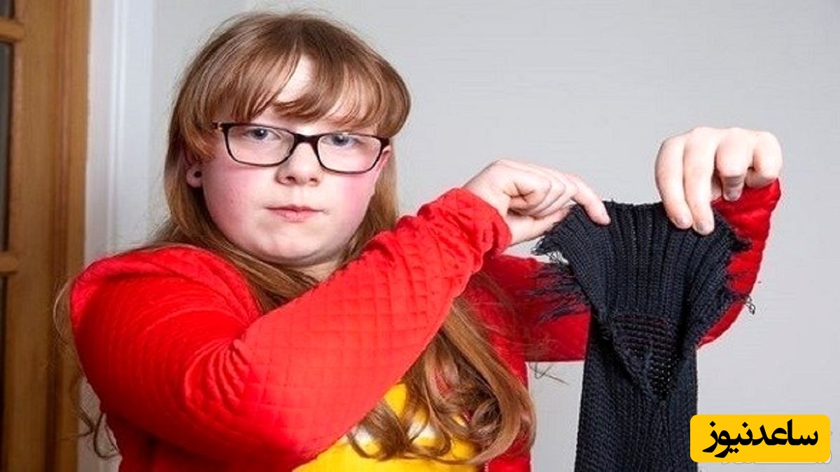 این دختر بچه همه چیز حتی لباس‌هایش را می خورد!