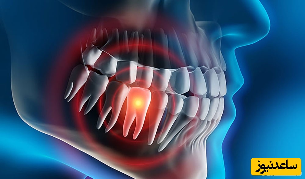 مزایای استفاده از لیزر برای کشیدن دندان چیست؟