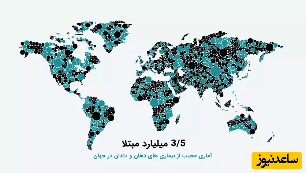 3/5 میلیارد مبتلا، آماری عجیب از بیماری های دهان و دندان در جهان