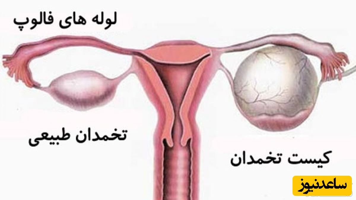 نقش لوله فالوپ در بارداری